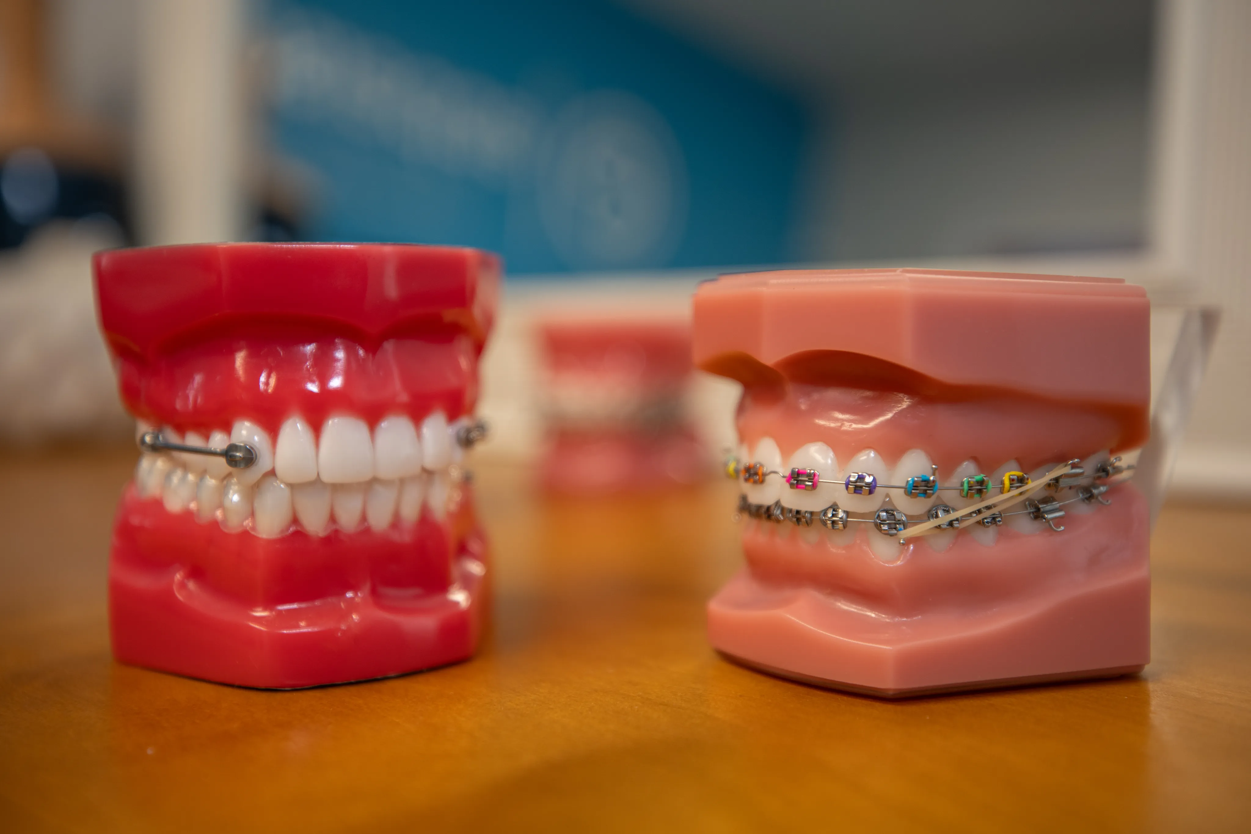 Early Orthodontics in Springfield, OR