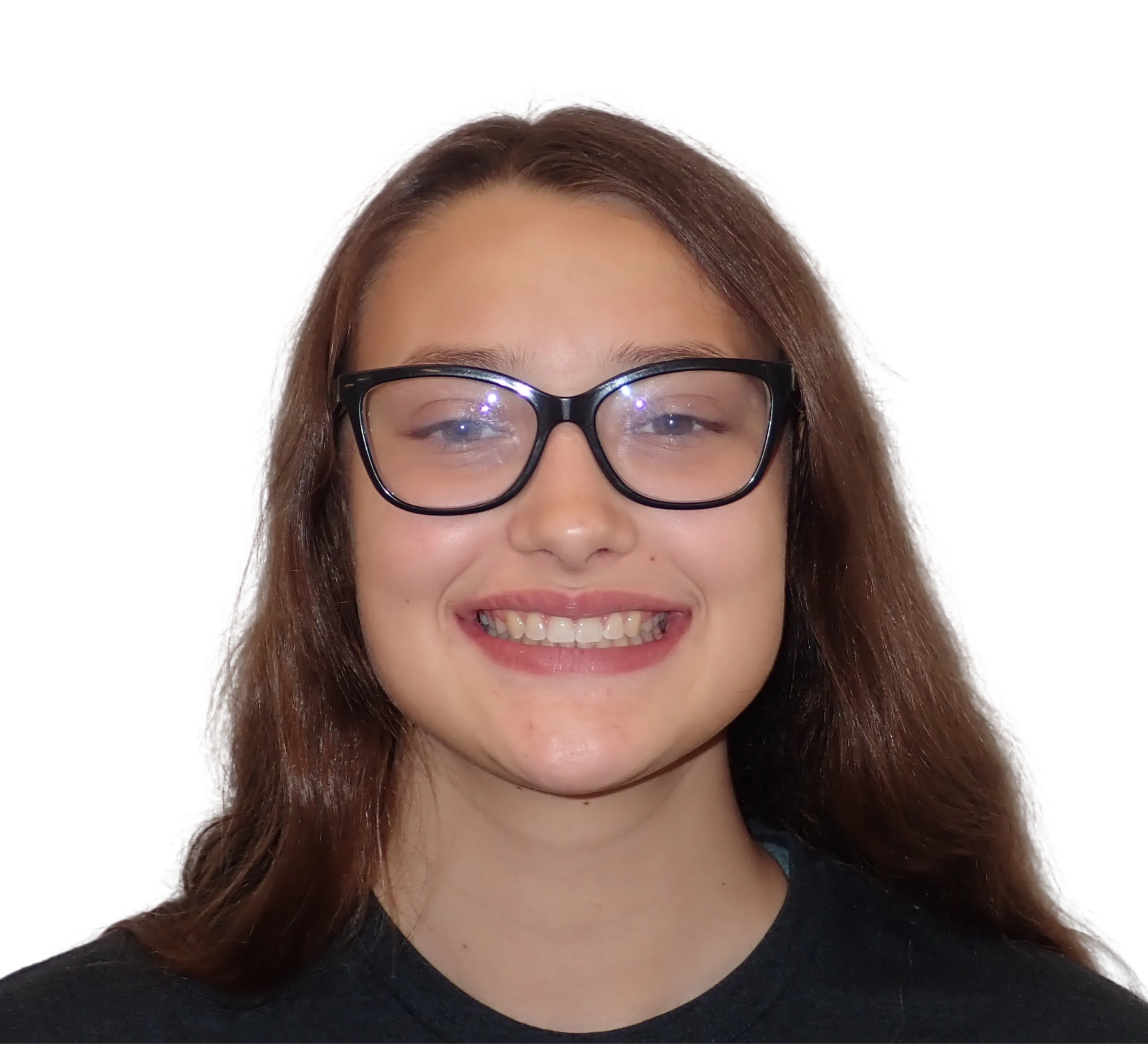 After orthodontic treatment - Case 42