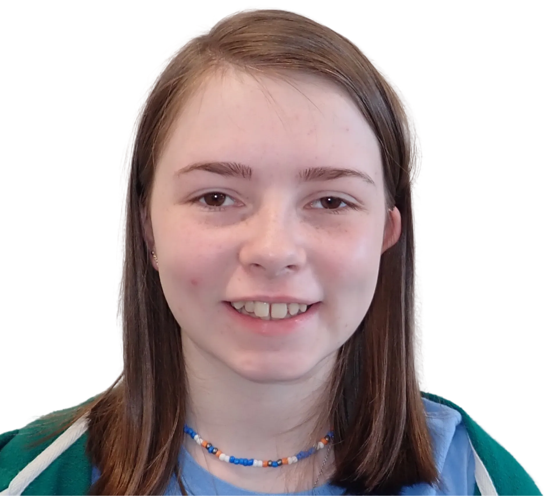 Before orthodontic treatment - Case 40