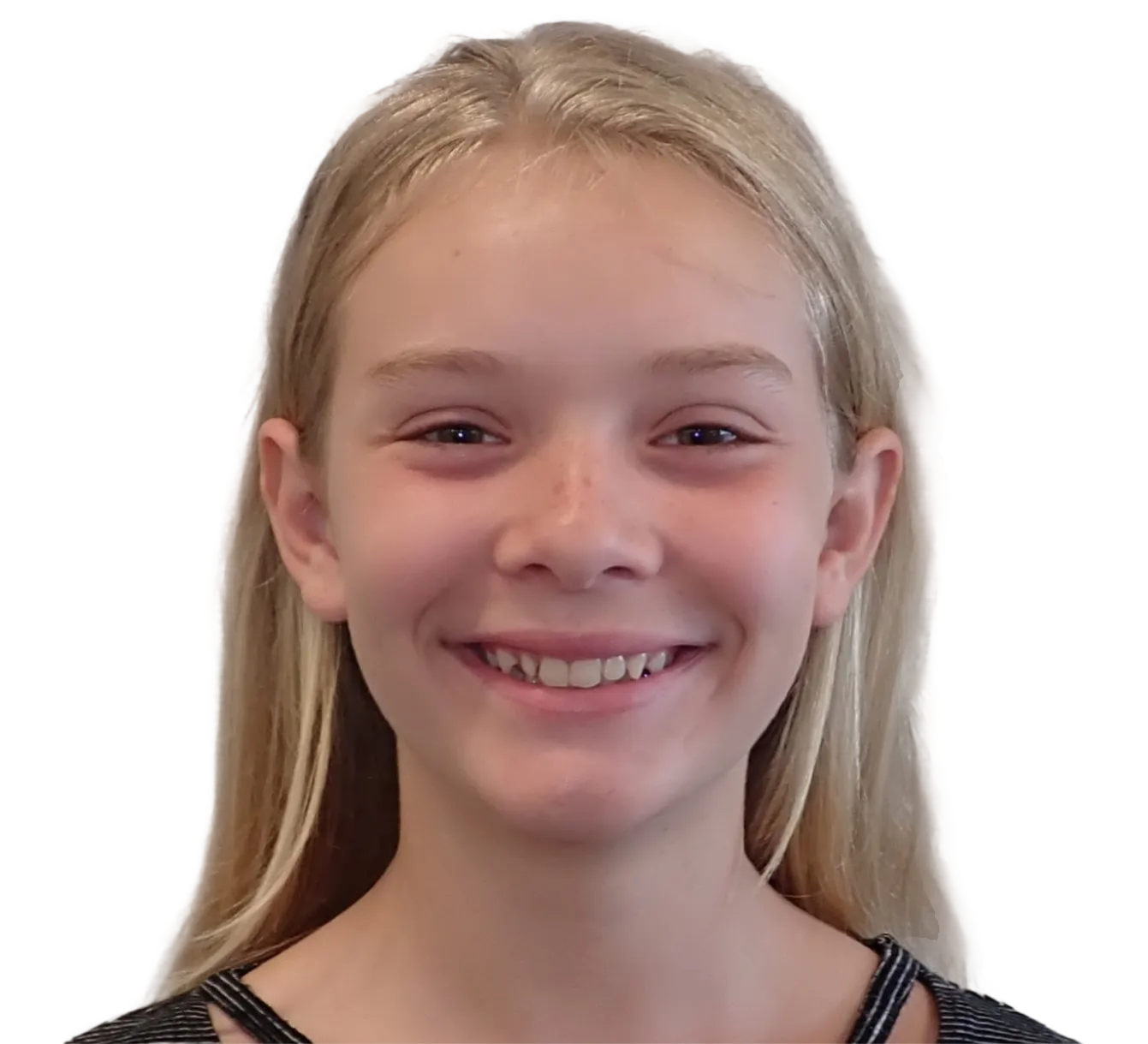 Before orthodontic treatment - Case 54