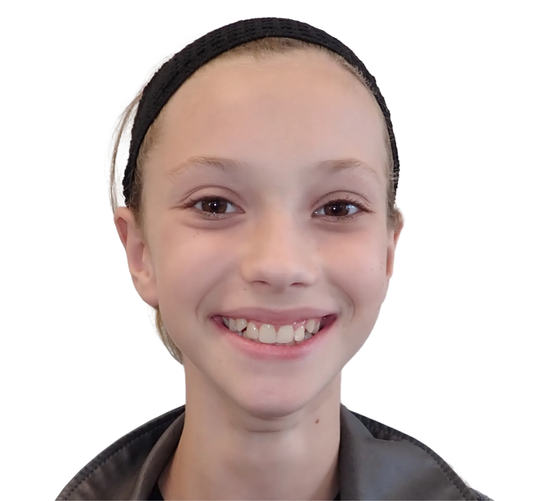 Before orthodontic treatment - Case 57
