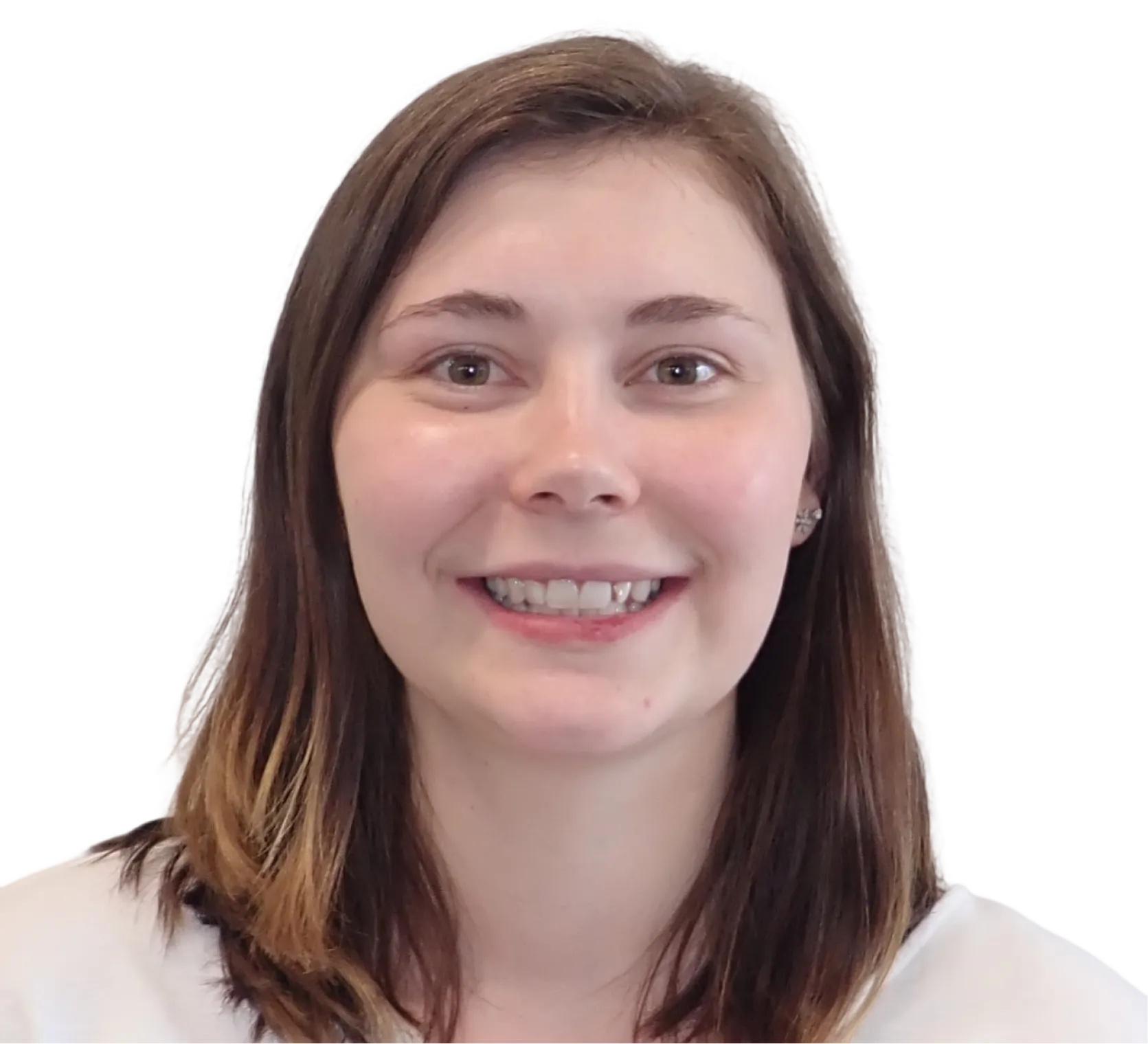 Before orthodontic treatment - Case 20